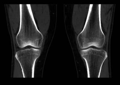 X-ray Knee