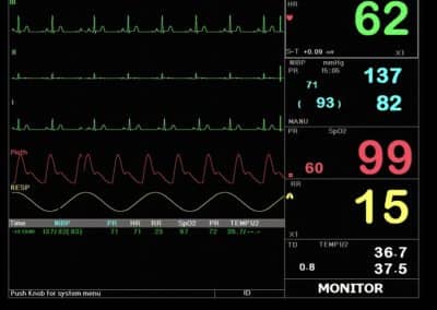 Macs 20 multi parameter patient monitor