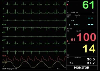 Macs 30 multi parameter patient monitor